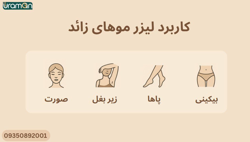 کاربردهای لیزر