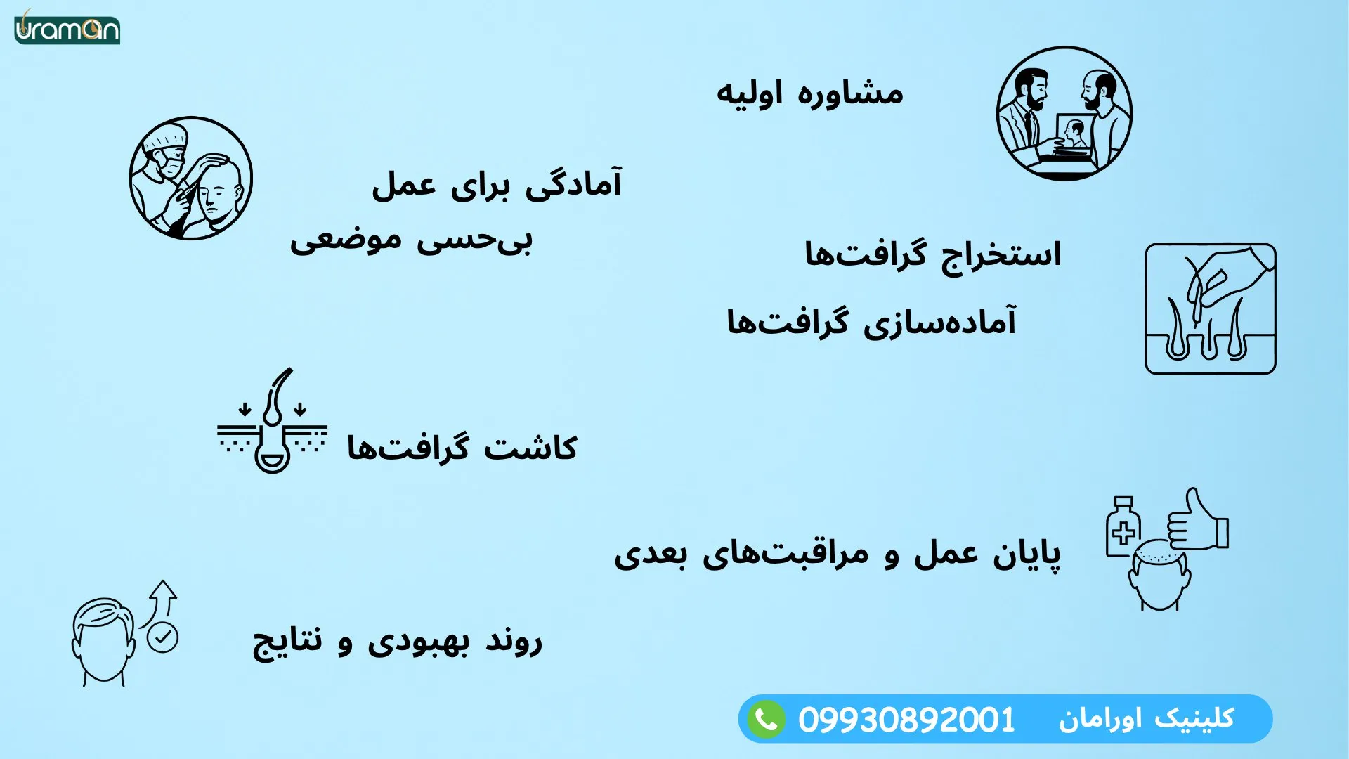 کاشت مو 