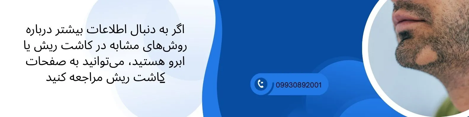 لینک به کاشت ریش