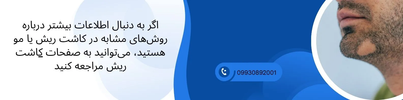 لینک به کاشت ریش