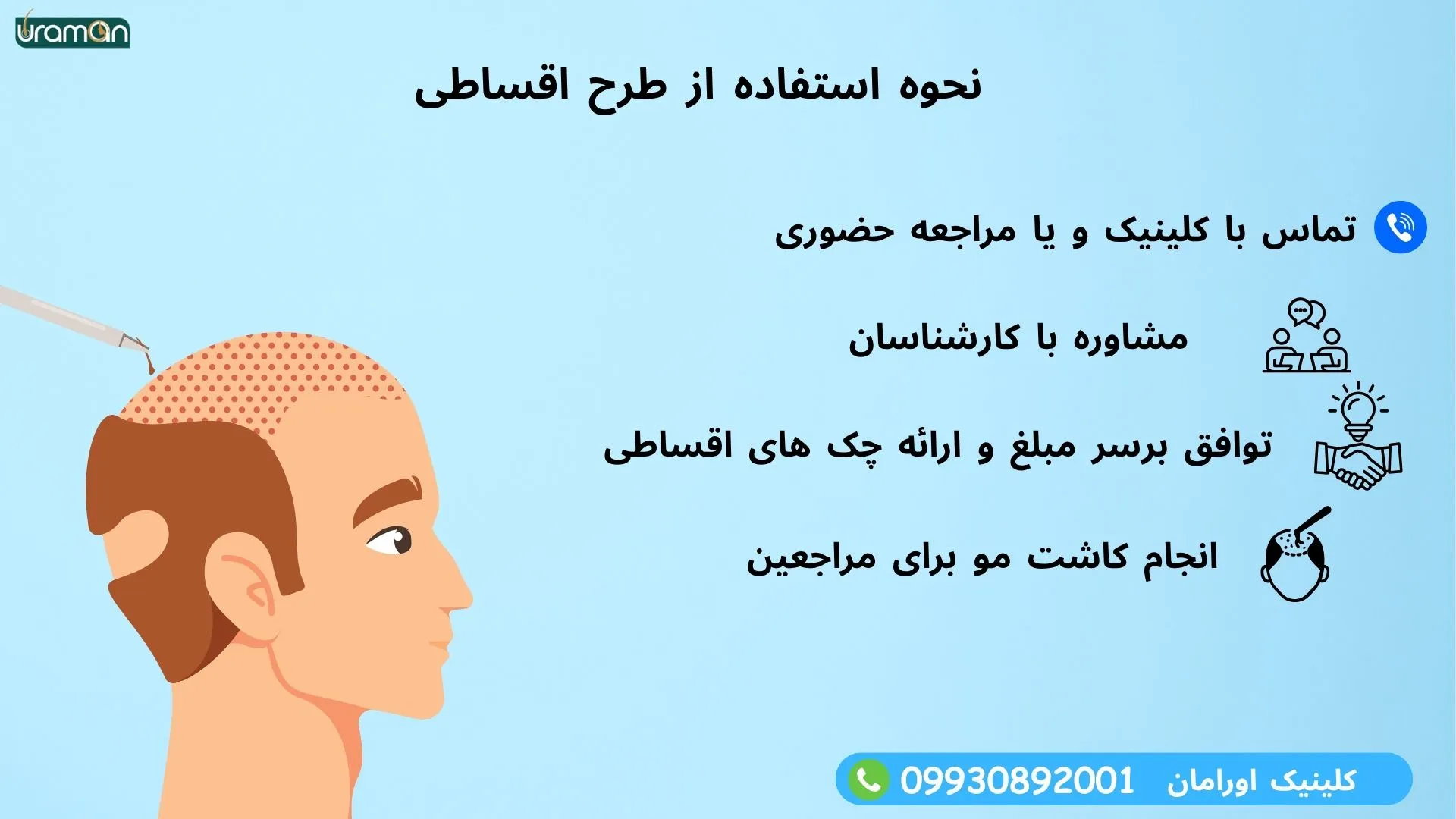 پرداخت اقساطی کاشت مو