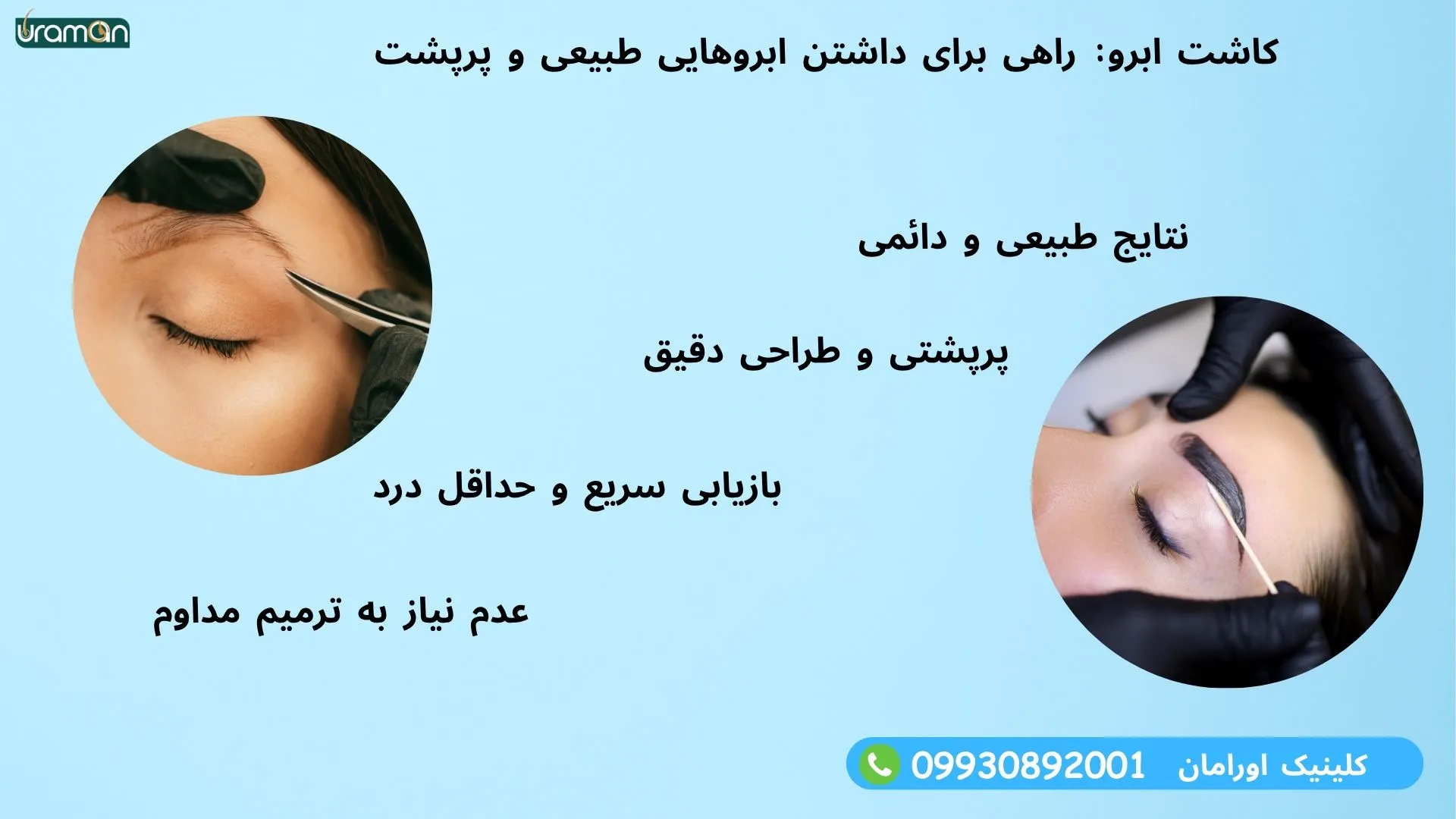مزایای کاشت ابرو