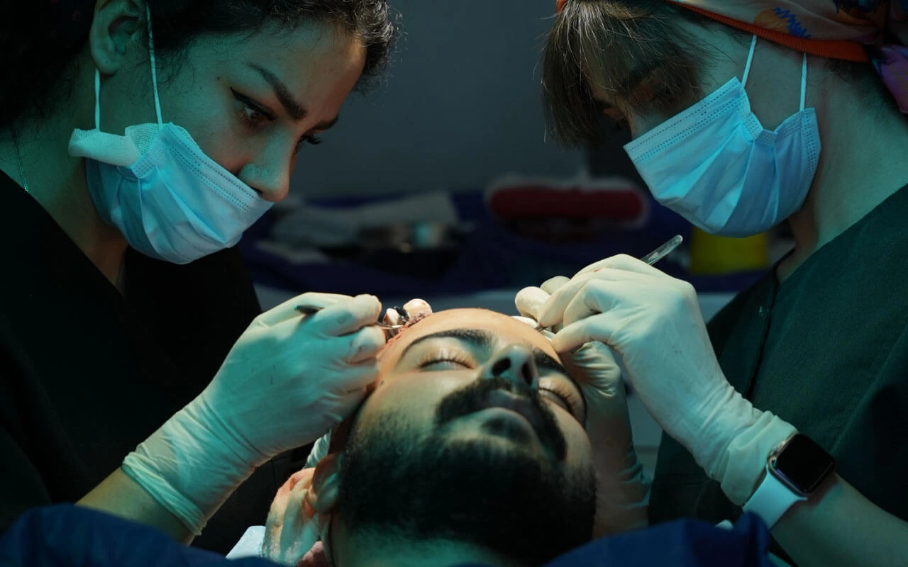 کاشت مو شیرازی در قزوین